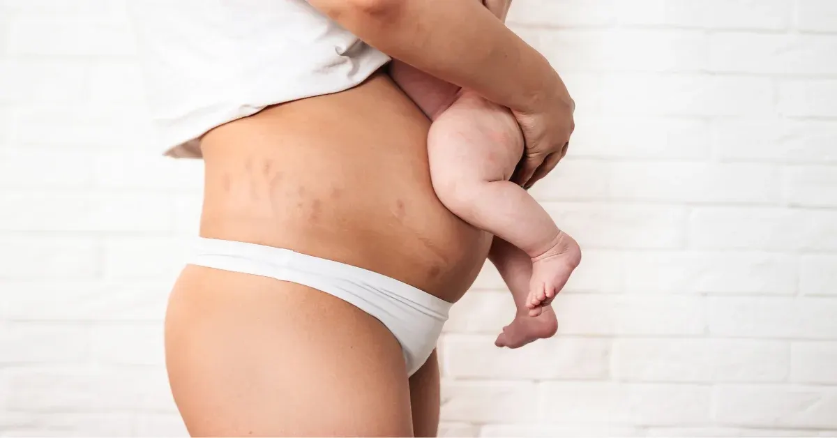 postpartum body